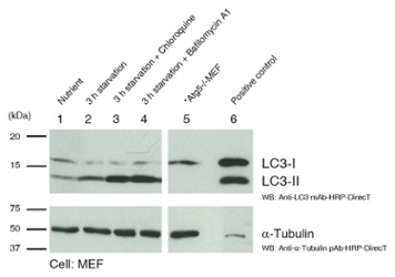Autophagy Watch WB Autophagy Watch WB