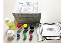 ELISA Anticuerpos Covid-19