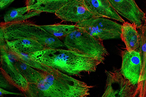 Fluoromount-G&reg; Anti-Fade