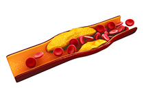 Medida de PCSK9 activa