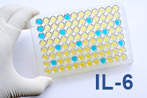 Cuantificacin de IL-6 con alta sensibilidad