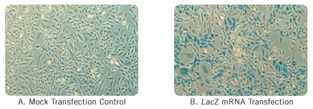 Transfeccin mRNA LacZ